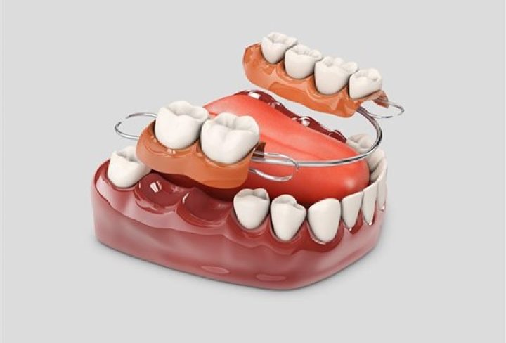 Dentures 2
